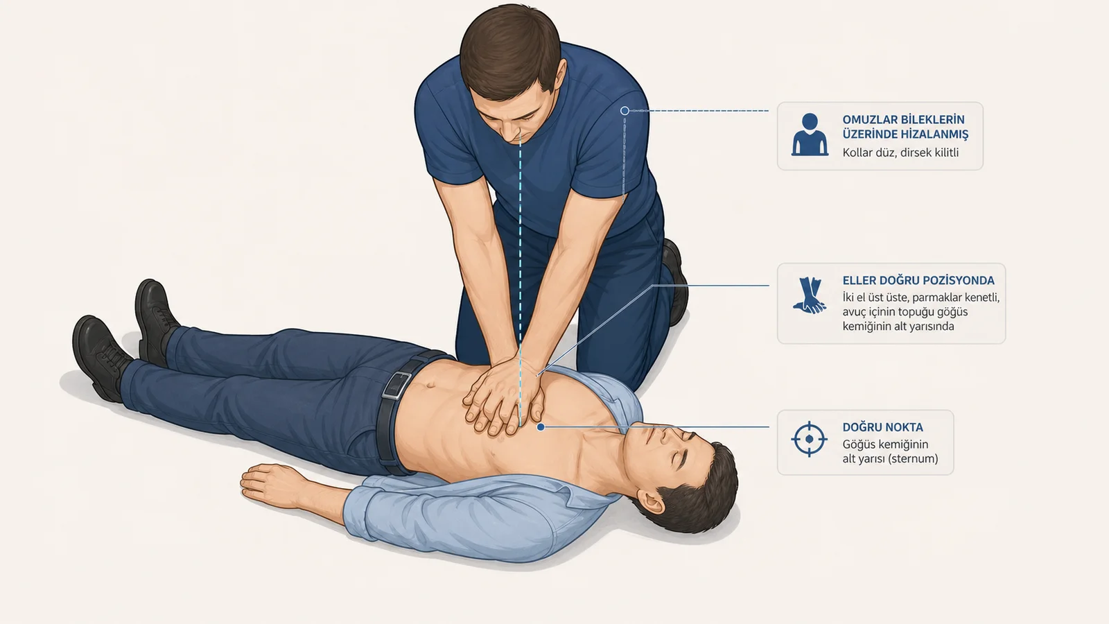 Üstten 30 derece açıyla görünüm: olay yerindeki kişinin iki eli üst üste, parmaklar kenetli, avuç içi hastanın göğüs kemiğinin alt yarısına yerleşmiş; kollar dirsekten düz.